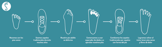 ¿POR QUÉ USAR ZAPATOS ERGONÓMICOS?